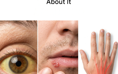 8 Signs of Vitamin B12 Deficiency and What to Do About It