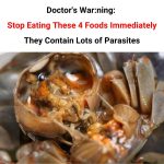 “Doctors warn: Limit eating these 4 foods immediately, they contain a lot of parasites” is spreading online?