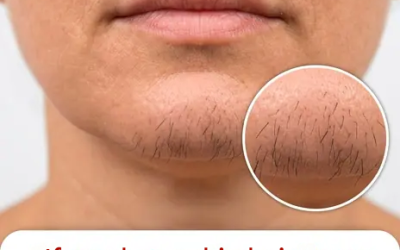 A few chin hairs on women: a common phenomenon, a natural bodily evolution, or simply an everyday detail? We explain it to you frankly and without dramatizing 👇