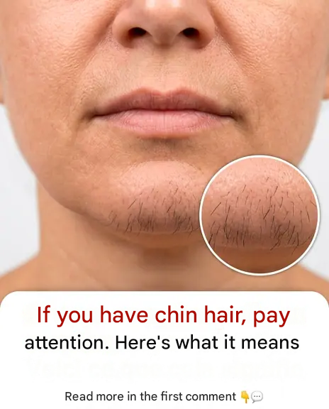 A few chin hairs on women: a common phenomenon, a natural bodily evolution, or simply an everyday detail? We explain it to you frankly and without dramatizing 👇