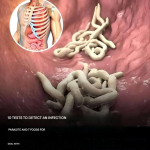 10 Signs That You Have a Parasite Infestation in Your Body?