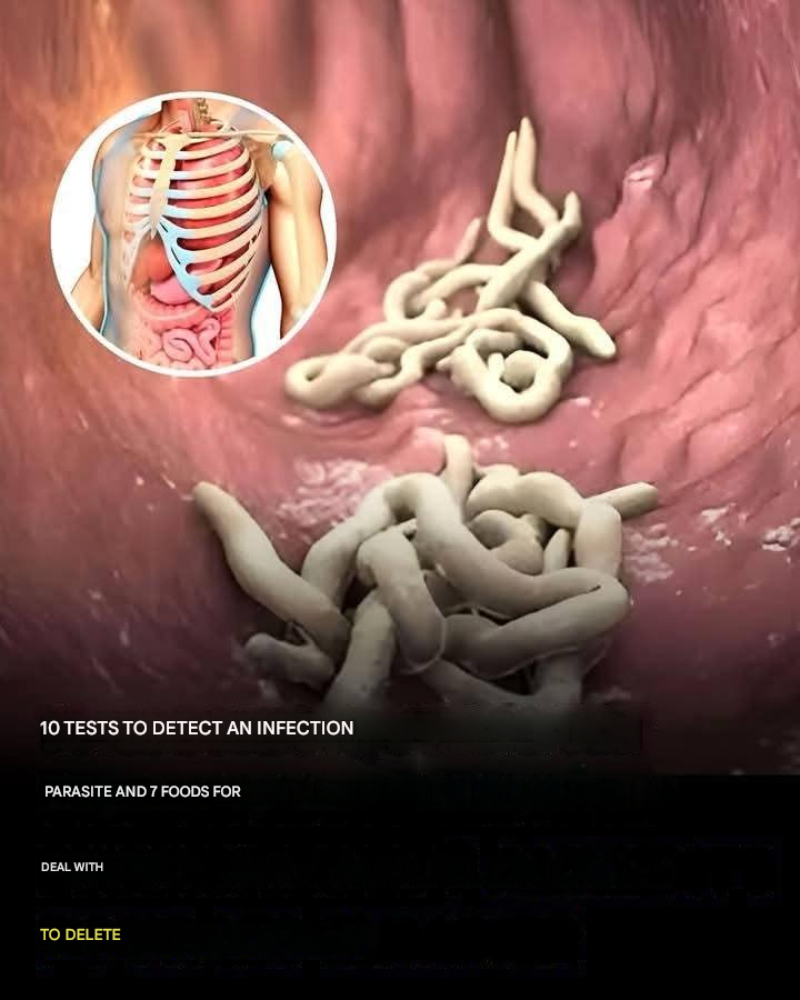 10 Signs That You Have a Parasite Infestation in Your Body?