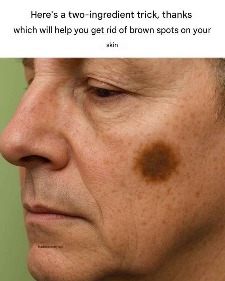 Here’s a two-ingredient trick to get rid of brown spots on your skin