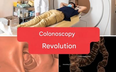 New method: colonoscopy will no longer be an invasive examination. (1/2)