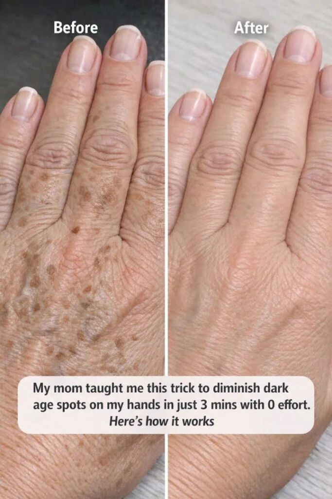 My mom taught me this trick to diminish dark age spots on my hands in just 3 mins with 0 effort. Here’s how it works